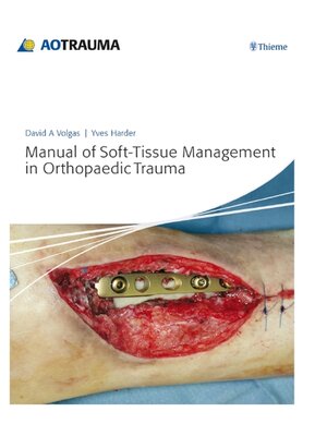 cover image of Manual of Soft-Tissue Management in Orthopaedic Trauma